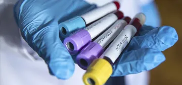 NRW Eyaleti’nde 5203 öğrencide koronavirüs çıktı