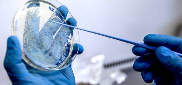 Koronavirüsün 2 varyantına aynı anda yakalanabiliniyor Koronavirüsün 2 varyantına aynı anda yakalanabiliniyor