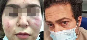 Almanya’da baba kıza polis şiddeti